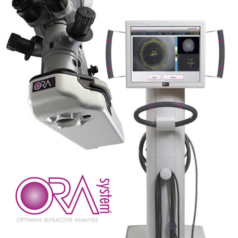 Bladeless Cataract Surgery Baton Rouge ORA System