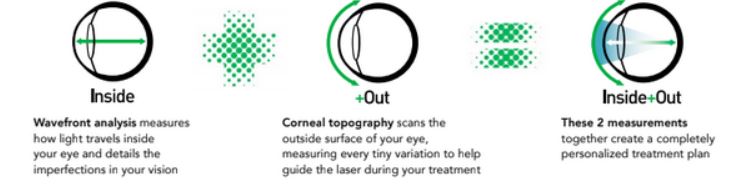 Diagram of Eye during iDesign procedure