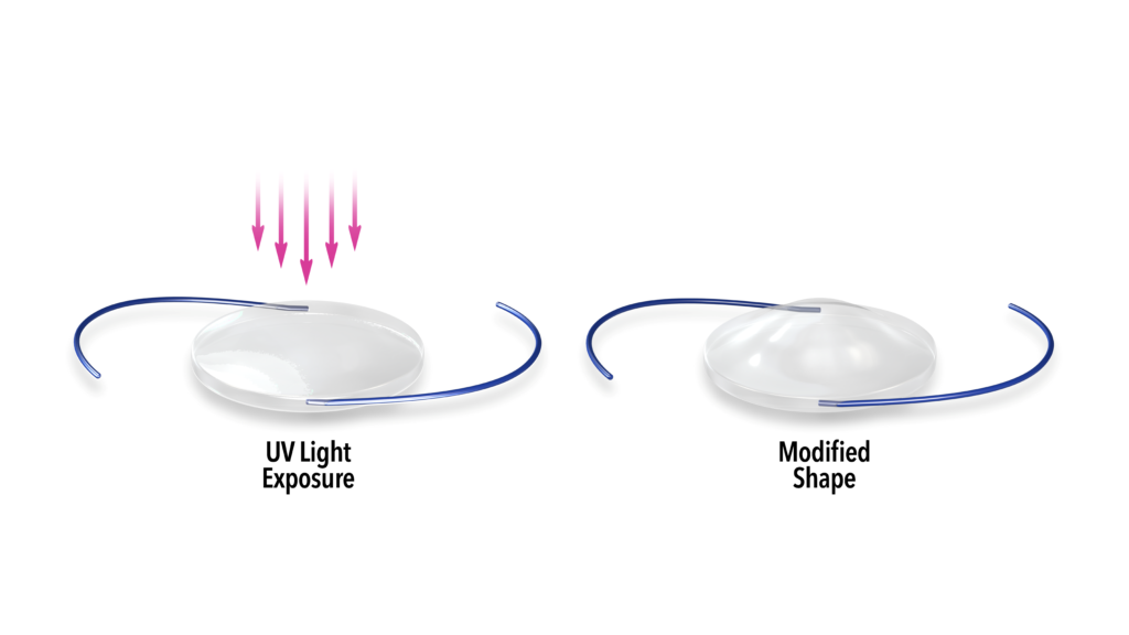 Lens Diagram showing the modified shape after UV Light Exposure