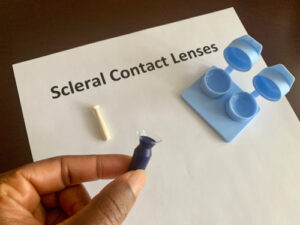 contact lenses